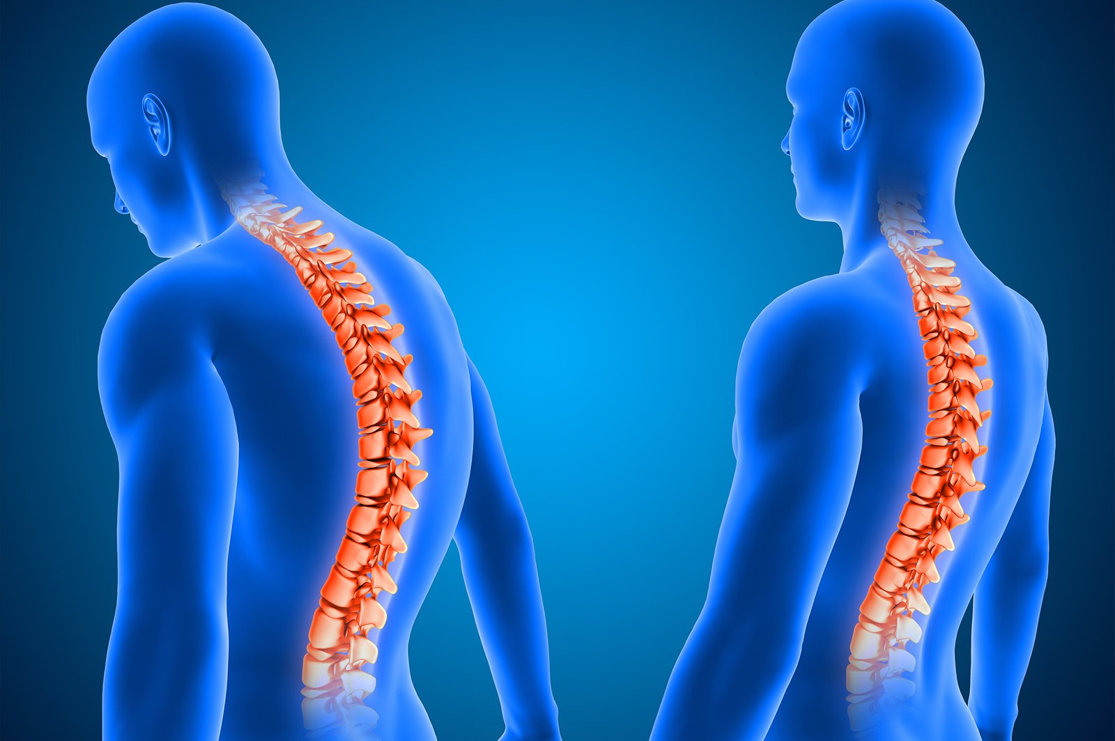 Spine-Injury